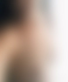 Skin Pics - post hidden image