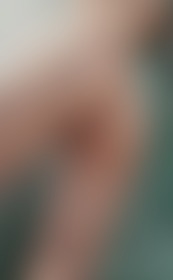🍑🍑🍑 - post hidden image