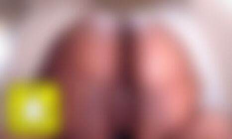Screenshot to Add 🤳 - post hidden image