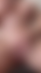 Appetizer - post hidden image