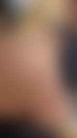 Xoxo - post hidden image