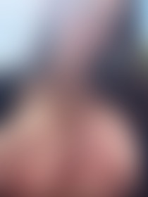 Beetje wazig door de zon 🍒🤭 - post hidden image