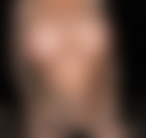 Melonen - post hidden image