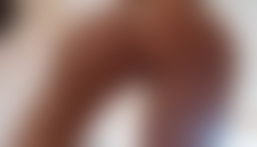 🍑🍑🍑 - post hidden image
