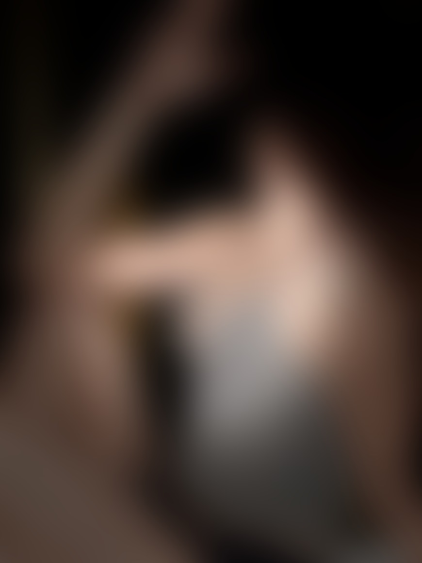 He bit me - post hidden image