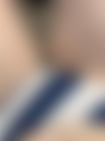 Little hair peeking through - post hidden image