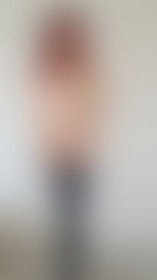 Bat or Nurse?! - post hidden image
