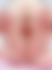 🍑🍑🍑 - post hidden image