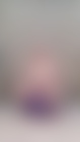 Skippy ball - post hidden image