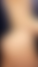🙈🙈 - post hidden image