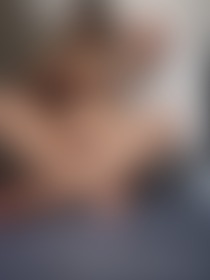 🍒🍒 - post hidden image