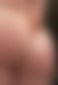 What’s a sunburnt ass good for, if naught but spanking 😉😌 - post hidden image